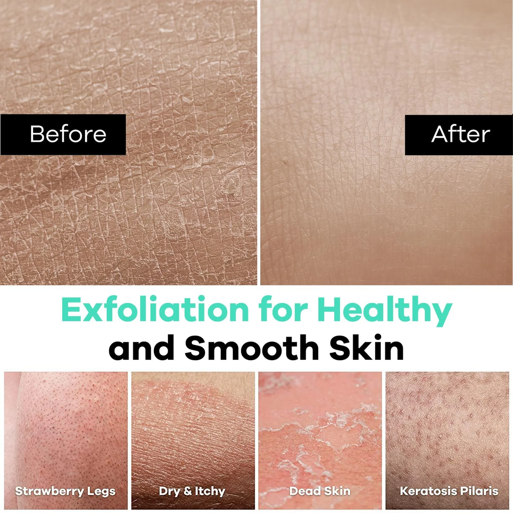 Exfoliating Body Mitt